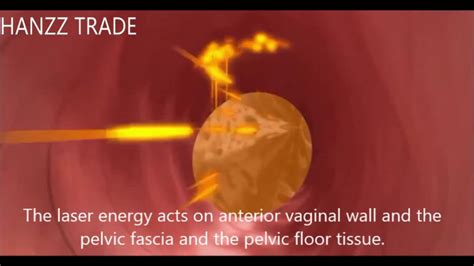 vajina|Vagina Picture Image on MedicineNet.com